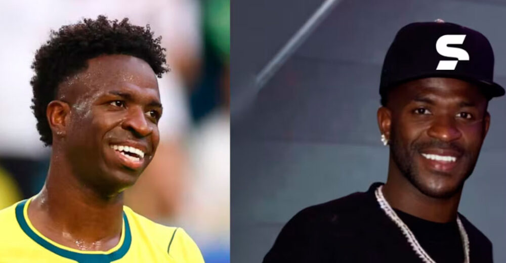 Pangling Banget! Wajah Vinicius Berubah Drastis Usai Operasi